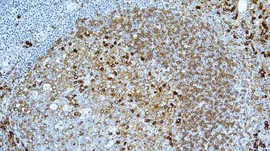 Mouse Anti-Human kappa light chain antibody [CH15]. GTX01892