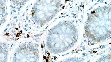 Anti-IL6 antibody [10C12] used in IHC (Paraffin sections) (IHC-P). GTX01893