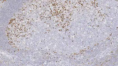 Anti-IRF4 / MUM1 antibody [EAU32] used in IHC (Paraffin sections) (IHC-P). GTX01894