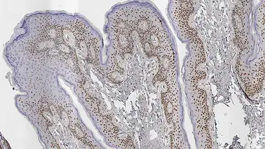 Anti-Androgen Receptor antibody [AR27] used in IHC (Paraffin sections) (IHC-P). GTX01898