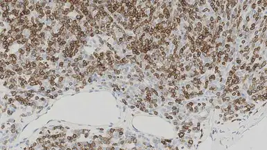 Anti-CD1a antibody [MTB1] used in IHC (Paraffin sections) (IHC-P). GTX01899