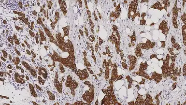 Anti-Cytokeratin 7 antibody [RN7] used in IHC (Paraffin sections) (IHC-P). GTX01903