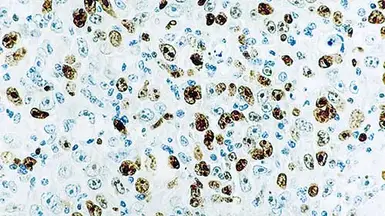 Anti-Ki67 antibody [MM1] used in IHC (Paraffin sections) (IHC-P). GTX01905
