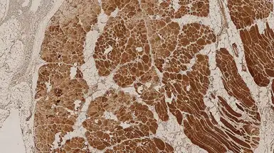 Anti-Dysferlin antibody [Ham1/7B6] used in IHC (Paraffin sections) (IHC-P). GTX01908