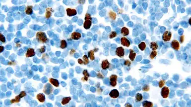 Anti-Geminin antibody [EM6] used in IHC (Paraffin sections) (IHC-P). GTX01909