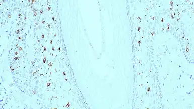 Anti-Langerin antibody [12D6] used in IHC (Paraffin sections) (IHC-P). GTX01915
