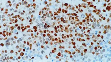 Anti-Myogenin antibody [LO26] used in IHC (Paraffin sections) (IHC-P). GTX01916