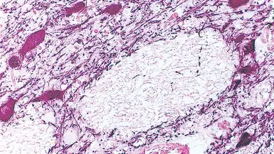 Anti-Tyrosine Hydroxylase antibody [1B5] used in IHC (Paraffin sections) (IHC-P). GTX01922