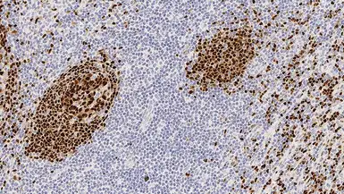Anti-PAX5 antibody [1EW] used in IHC (Paraffin sections) (IHC-P). GTX01923