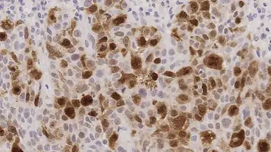 Anti-PLK1 antibody [MJS1] used in IHC (Paraffin sections) (IHC-P). GTX01927
