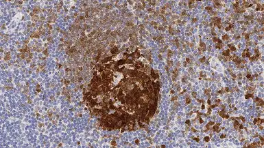 Anti-BOB1 antibody [TG14] used in IHC (Paraffin sections) (IHC-P). GTX01929