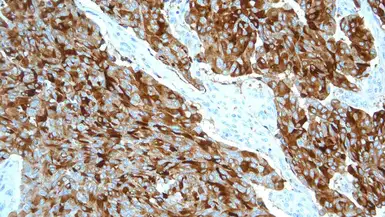 Anti-Calcitonin antibody [CL1948] used in IHC (Paraffin sections) (IHC-P). GTX01932