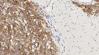 Anti-TMEM16A antibody [K9] used in IHC (Paraffin sections) (IHC-P). GTX01933