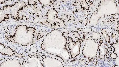 Anti-NKX2.1 antibody [SPT24] used in IHC (Paraffin sections) (IHC-P). GTX01952