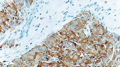 Anti-Synaptophysin antibody [27G12] used in IHC (Paraffin sections) (IHC-P). GTX01953