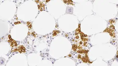 Anti-CD71 antibody [10F11] used in IHC (Paraffin sections) (IHC-P). GTX01954