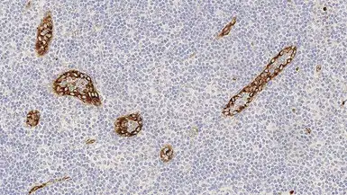 Anti-VWF antibody [36B11] used in IHC (Paraffin sections) (IHC-P). GTX01957