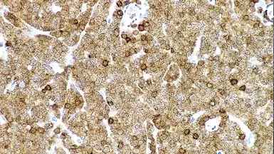 Anti-ZAP70 antibody [L453R] used in IHC (Paraffin sections) (IHC-P). GTX01960