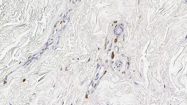 Anti-Mast cell tryptase antibody [10D11] used in IHC (Paraffin sections) (IHC-P). GTX01964