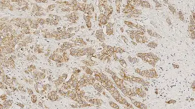 Anti-E-Cadherin antibody [36B5] used in IHC (Paraffin sections) (IHC-P). GTX01965