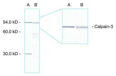 Anti-Calpain 3 antibody [Calp3d/2C4] used in Western Blot (WB). GTX01971