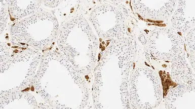 Anti-Calretinin antibody [CAL6] used in IHC (Paraffin sections) (IHC-P). GTX01973