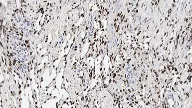 Anti-KSHV ORF73 antibody [13B10] used in IHC (Paraffin sections) (IHC-P). GTX01981