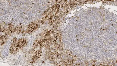 Anti-CD99 antibody [PCB1] used in IHC (Paraffin sections) (IHC-P). GTX01982