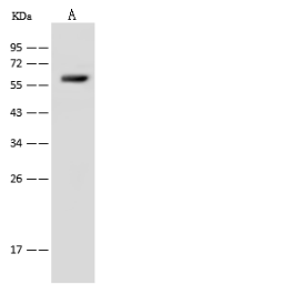 Anti-SLC22A12 antibody used in Western Blot (WB). GTX02463