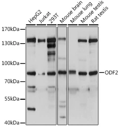 Anti-ODF2 antibody used in Western Blot (WB). GTX02526