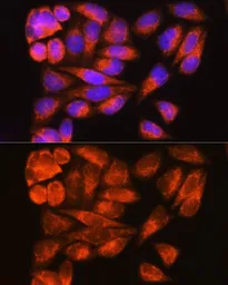 Anti-ODF2 antibody used in Immunocytochemistry/ Immunofluorescence (ICC/IF). GTX02526