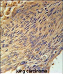 Anti-CPEB4 antibody used in IHC (Paraffin sections) (IHC-P). GTX02529