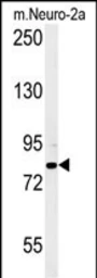 Anti-CPEB4 antibody used in Western Blot (WB). GTX02529