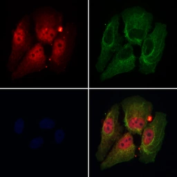 Anti-DDX17 antibody used in Immunocytochemistry/ Immunofluorescence (ICC/IF). GTX02534