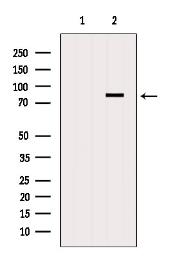 Anti-DDX17 antibody used in Western Blot (WB). GTX02534