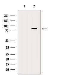 Anti-DDX17 antibody used in Western Blot (WB). GTX02534
