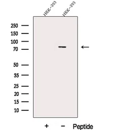 Anti-DDX17 antibody used in Western Blot (WB). GTX02534