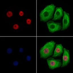 Anti-Histone H3K9K14K23K27ac (Acetyl Lys9/Lys14/Lys23/Lys27) antibody used in Immunocytochemistry/ Immunofluorescence (ICC/IF). GTX02535