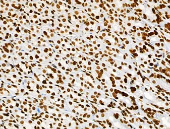 Anti-Histone H3K9K14K23K27ac (Acetyl Lys9/Lys14/Lys23/Lys27) antibody used in IHC (Paraffin sections) (IHC-P). GTX02535