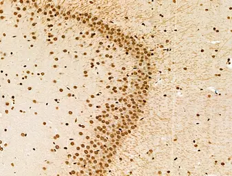 Anti-Histone H3K9K14K23K27ac (Acetyl Lys9/Lys14/Lys23/Lys27) antibody used in IHC (Paraffin sections) (IHC-P). GTX02535