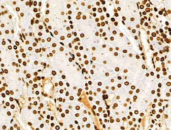 Anti-Histone H3K9K14K23K27ac (Acetyl Lys9/Lys14/Lys23/Lys27) antibody used in IHC (Paraffin sections) (IHC-P). GTX02535