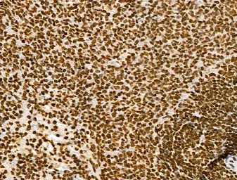 Anti-Histone H3K9K14K23K27ac (Acetyl Lys9/Lys14/Lys23/Lys27) antibody used in IHC (Paraffin sections) (IHC-P). GTX02535