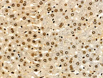 Anti-Histone H3K9K14K23K27ac (Acetyl Lys9/Lys14/Lys23/Lys27) antibody used in IHC (Paraffin sections) (IHC-P). GTX02535