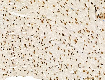 Anti-Histone H3K9K14K23K27ac (Acetyl Lys9/Lys14/Lys23/Lys27) antibody used in IHC (Paraffin sections) (IHC-P). GTX02535