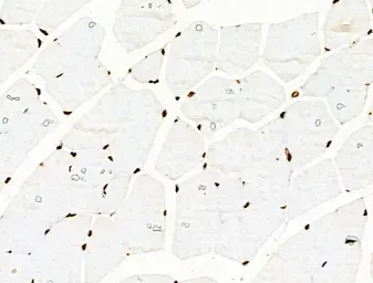 Anti-Histone H3K9K14K23K27ac (Acetyl Lys9/Lys14/Lys23/Lys27) antibody used in IHC (Paraffin sections) (IHC-P). GTX02535