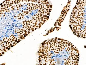 Anti-Histone H3K9K14K23K27ac (Acetyl Lys9/Lys14/Lys23/Lys27) antibody used in IHC (Paraffin sections) (IHC-P). GTX02535