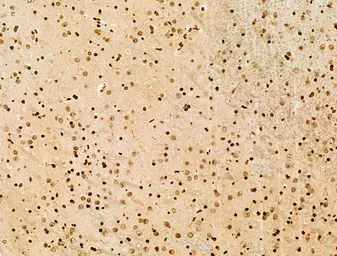 Anti-Histone H3K9K14K23K27ac (Acetyl Lys9/Lys14/Lys23/Lys27) antibody used in IHC (Paraffin sections) (IHC-P). GTX02535