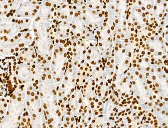 Anti-Histone H3K9K14K23K27ac (Acetyl Lys9/Lys14/Lys23/Lys27) antibody used in IHC (Paraffin sections) (IHC-P). GTX02535