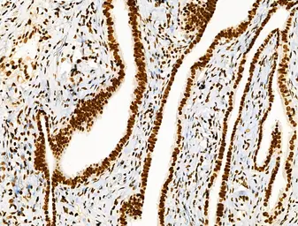 Anti-Histone H3K9K14K23K27ac (Acetyl Lys9/Lys14/Lys23/Lys27) antibody used in IHC (Paraffin sections) (IHC-P). GTX02535