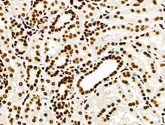 Anti-Histone H3K9K14K23K27ac (Acetyl Lys9/Lys14/Lys23/Lys27) antibody used in IHC (Paraffin sections) (IHC-P). GTX02535